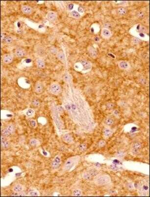 Immunohistochemistry-Paraffin: Adenosine A2aR Antibody (7F6-G5-A2) - Azide and BSA Free [NBP2-80562] - Analysis of a FFPE tissue section of mouse brain using Adenosine A2a R antibody (clone 7F6-G5-A2) at 1:400 dilution. The antibody generated nice membranous / punctate staining of Adenosine A2a receptors. Image from the standard format of this antibody.