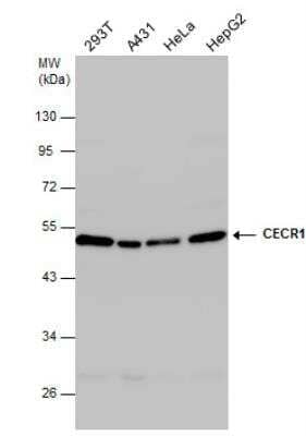 Western Blot: Adenosine Deaminase 2/CECR1 Antibody [NBP2-15855] - Various whole cell extracts (30 ug) were separated by 10% SDS-PAGE, and the membrane was blotted with CECR1 antibody diluted at 1:1000.