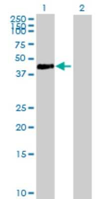Western Blot: Adenosine Deaminase/ADA Antibody [H00000100-B01P] - Analysis of ADA expression in transfected 293T cell line by ADA polyclonal antibody.  Lane 1: ADA transfected lysate(39.93 KDa). Lane 2: Non-transfected lysate.