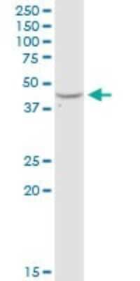 Western Blot: Adenosine Deaminase/ADA Antibody [H00000100-D01P] - Analysis of ADA expression in Jurkat.