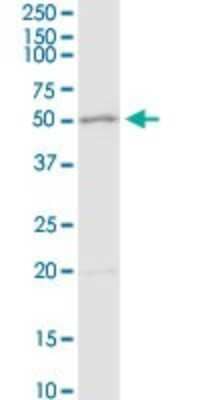 Western Blot: Adenosine Deaminase/ADA Antibody [H00000100-D01P] - Analysis of ADA expression in NIH/3T3.