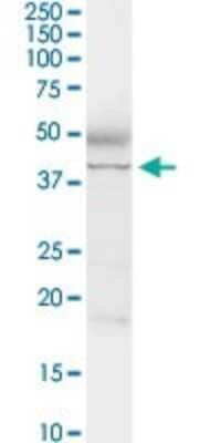 Western Blot: Adenosine Deaminase/ADA Antibody [H00000100-D01P] - Analysis of ADA expression in human colon.