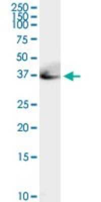Western Blot: Adenosine Deaminase/ADA Antibody [H00000100-D01P] - Analysis of ADA expression in mouse kidney.