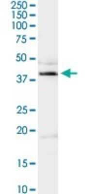 Western Blot: Adenosine Deaminase/ADA Antibody [H00000100-D01P] - Analysis of ADA expression in rat brain.