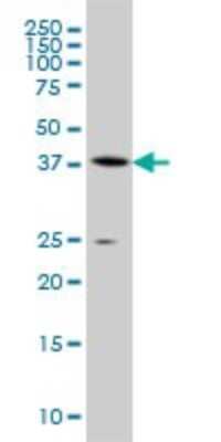 Western Blot: Adenosylhomocysteinase/AHCY Antibody (4H2) [H00000191-M07A] - Analysis of AHCY expression in A-549 (Cat # L025V1).