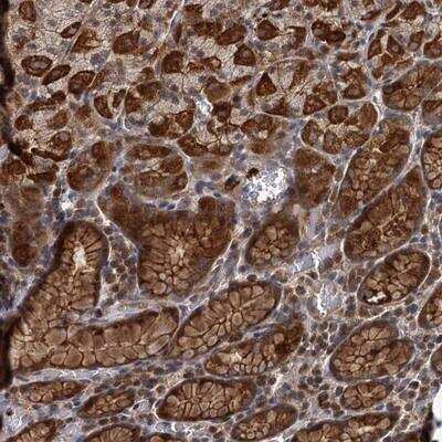 Immunohistochemistry Adenylate Cyclase 2 Antibody - BSA Free