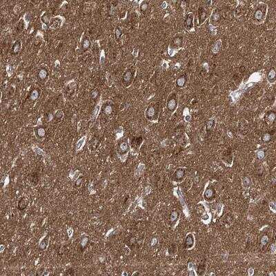 Immunohistochemistry: Adenylate Cyclase 2 Antibody [NBP1-90281] - Staining of human hippocampus shows strong cytoplasmic positivity in neuronal cells.