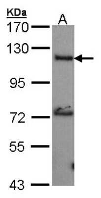 Western Blot Adenylate Cyclase 2 Antibody - BSA Free