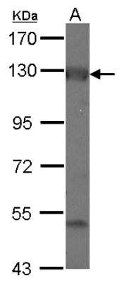 Western Blot: Adenylate Cyclase 2 Antibody [NBP2-15292] - Sample (30 ug of whole cell lysate) A: IMR32 7.5% SDS PAGE; antibody diluted at 1:1000.