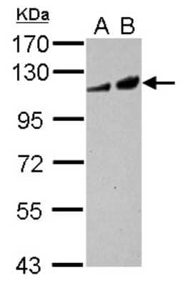 Western Blot: Adenylate Cyclase 2 Antibody [NBP2-15293] - Sample (30 ug of whole cell lysate) A: U87-MG B: MCF-7 7.5% SDS PAGE; antibody diluted at 1:1000.
