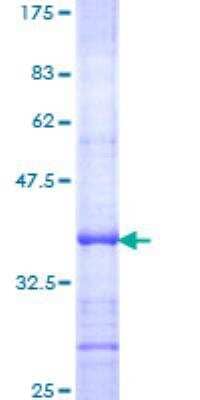 SDS-Page: Adenylate Cyclase 7 Partial Recombinant Protein [H00000113-Q01]