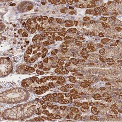 Immunohistochemistry: Adenylate Cyclase 9 Antibody [NBP2-30380] - Staining of human stomach, lower shows strong cytoplasmic positivity in glandular cells.