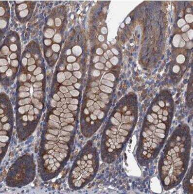 Immunohistochemistry Adenylate Cyclase 9 Antibody