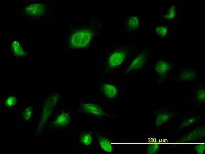 Immunocytochemistry/Immunofluorescence: Adenylate Kinase 1 Antibody (3A6-1F5) [H00000203-M06] - Analysis of monoclonal antibody to AK1 on HeLa cell. Antibody concentration 10 ug/ml