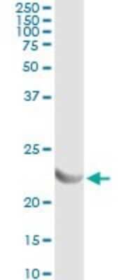 Immunoprecipitation: Adenylate Kinase 1 Antibody (3A6-1F5) [H00000203-M06] - Analysis of AK1 transfected lysate using anti-AK1 monoclonal antibody and Protein A Magnetic Bead, and immunoblotted with AK1 rabbit polyclonal antibody.