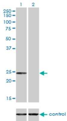 Western Blot: Adenylate Kinase 1 Antibody (3A6-1F5) [H00000203-M06] - Western blot analysis of AK1 over-expressed 293 cell line. Lane 2 cotransfected with AK1 Validated Chimera RNAi Lane 1 non-transfected control. Blot probed with H00000203-M06. GAPDH ( 36.1 kDa ) used as loading control.