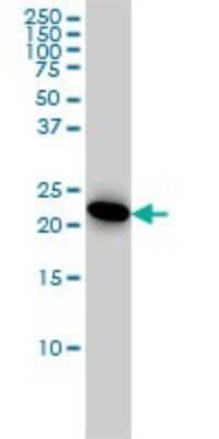 Western Blot: Adenylate Kinase 1 Antibody (3A6-1F5) [H00000203-M06] - Analysis of AK1 expression in HeLa (Cat # L013V1).