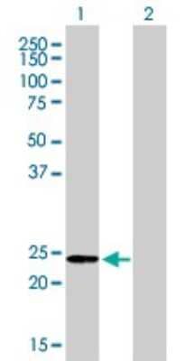 Western Blot Adenylate Kinase 1 Antibody (3A6-1F5)