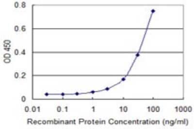 ELISA: Adenylate Kinase 1 Antibody (3G8-1B11) [H00000203-M01] - Detection limit for recombinant GST tagged AK1 is approximately 10ng/ml as a capture antibody.