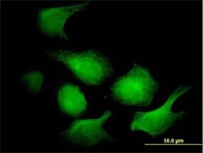 Immunocytochemistry/Immunofluorescence: Adenylate Kinase 1 Antibody (3G8-1B11) [H00000203-M01] - Analysis of monoclonal antibody to AK1 on HeLa cell. Antibody concentration 10 ug/ml.