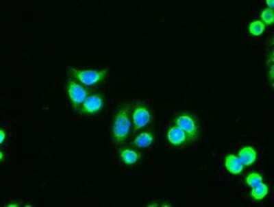 Immunocytochemistry/Immunofluorescence: Adenylate Kinase 1 Antibody (4A1) [NBP1-47655] - Immunofluorescent staining of HT29 cells using anti-Adenylate Kinase 1 mouse monoclonal antibody.