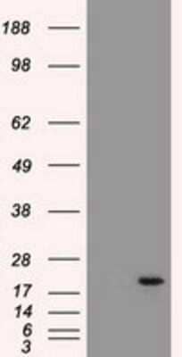 Western Blot: Adenylate Kinase 1 Antibody (4A1) [NBP1-47655] - HEK293T cells were transfected with the pCMV6-ENTRY control (Left lane) or pCMV6-ENTRY Adenylate Kinase 1 (Right lane) cDNA for 48 hrs and lysed. Equivalent amounts of cell lysates (5 ug per lane) were separated by SDS-PAGE and immunoblotted with anti-Adenylate Kinase 1.