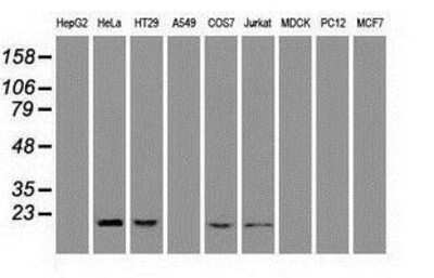 Western Blot: Adenylate Kinase 1 Antibody (4A1) [NBP1-47655] Analysis of extracts (35ug) from 9 different cell lines by using anti-Adenylate Kinase 1 monoclonal antibody.