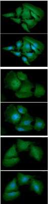 Immunocytochemistry/Immunofluorescence: Adenylate Kinase 1 Antibody (7E9) [NBP2-59485] - Analysis of AK1 in HeLa cell line, stained with DAPI (Blue) for nucleus staining and monoclonal anti-human AK1 antibody (1:100) with goat anti-mouse IgG-Alexa fluor 488 conjugate (Green). Analysis of AK1 in Hep3B cell line, stained with DAPI (Blue) for nucleus staining and monoclonal anti-human AK1 antibody (1:100) with goat anti-mouse IgG-Alexa fluor 488 conjugate (Green). Analysis of AK1 in A549 cell line, stained with DAPI (Blue) for nucleus staining and monoclonal anti-human AK1 antibody (1:100) with goat anti-mouse IgG-Alexa fluor 488 conjugate (Green).