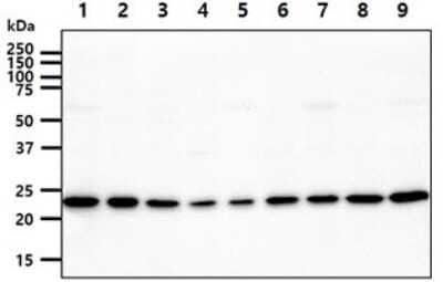 Western Blot: Adenylate Kinase 1 Antibody (7E9) [NBP2-59485] - Lane 1: HeLa cell lysates, Lane 2: U87-MG cell lysates, Lane 3: K562 cell lysates, Lane 4: 293T cell lysates, Lane 5: HepG2 cell lysates, Lane 6: A549 cell lysates, Lane 7: MCF7cell lysates, Lane 8: SK-OV-3 cell lysates, Lane 9: PC3 cell lysates