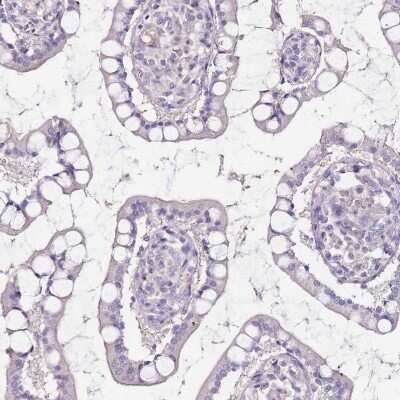 Immunohistochemistry-Paraffin: Adenylate Kinase 1 Antibody [NBP1-87401] - Staining of human small intestine shows low expression as expected.