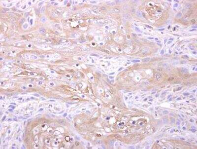 <b>Genetic Strategies Validation. </b>Immunohistochemistry-Paraffin: Adenylate Kinase 1 Antibody [NBP2-15295] - Ca922 xenograft.