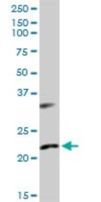 Western Blot: Adenylate Kinase 1 Antibody [H00000203-D01P] - Analysis of AK1 expression in NIH/3T3.
