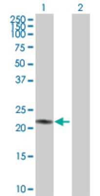 Western Blot: Adenylate Kinase 1 Antibody [H00000203-D01P] - Analysis of AK1 expression in transfected 293T cell line by AK1 polyclonal antibody.Lane 1: AK1 transfected lysate(21.60 KDa).Lane 2: Non-transfected lysate.