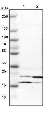 Western Blot: Adenylate Kinase 1 Antibody [NBP1-87401] - Lane 1: NIH-3T3 cell lysate (Mouse embryonic fibroblast cells). Lane 2: NBT-II cell lysate (Rat Wistar bladder tumor cells).