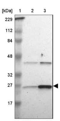 Western Blot: Adenylate Kinase 1 Antibody [NBP1-87401] - Lane 1: Marker  [kDa] 229, 112, 84, 48, 32, 27, 17.  Lane 2: Human cell line RT-4.  Lane 3: Human cell line U-251MG sp