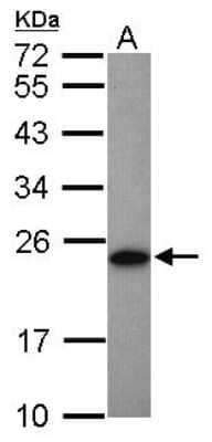 Western Blot: Adenylate Kinase 1 Antibody [NBP2-15295] - Sample (50 ug of whole cell lysate) A: Mouse brown adipose tissue 12% SDS PAGE; antibody diluted at 1:1000.