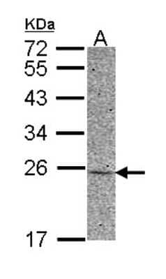 Western Blot: Adenylate Kinase 1 Antibody [NBP2-15295] - Sample (30 ug of whole cell lysate) A: HCT116 12% SDS PAGE, antibody diluted at 1:500.