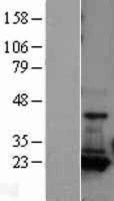 Western Blot Adenylate Kinase 1 Overexpression Lysate