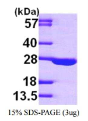 SDS-PAGE Recombinant Human Adenylate Kinase 1 His Protein