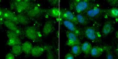 Immunocytochemistry/Immunofluorescence: Adenylate Kinase 6 Antibody (B1-F4) [NBP2-67116] - Staining AK6 in MCF-7 cells (green). The nuclear counter stain is DAPI (blue). Cells were fixed in paraformaldehyde, permeabilised with 0.25% Triton X100/PBS.