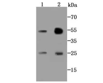 Western Blot: Adenylate Kinase 6 Antibody (B1-F4) [NBP2-67116] - Analysis of AK6 on MCF-7 cell (1) and human lung tissue (2) lysate using anti-AK6 antibody at 1/1000 dilution.