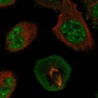 Immunocytochemistry/Immunofluorescence: Adenylate Kinase 6 Antibody [NBP3-17464] - Staining of human cell line U-2 OS shows localization to nuclear speckles, cytosol & centrosome.