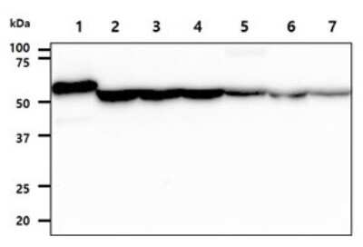 Western Blot: Adenylosuccinate Lyase Antibody (16C10) [NBP2-59414] - Lane 1: Recombinant Protein, Lane 2: HeLa cell lysates, Lane 3: 293T cell lysates  Lane 4: Jurkat cell lysates, Lane 5: HepG2 cell lysates  Lane 6: A549 cell lysates  Lane 7: MCF7 cell lysates