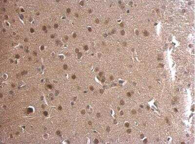 Immunohistochemistry-Paraffin: Adenylosuccinate Lyase Antibody [NBP2-15296] - Paraffin-embedded mouse fore brain. ADSL antibody [N3C3] dilution: 1:500.