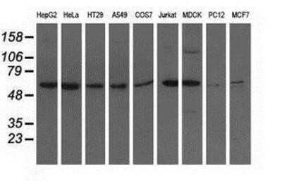 Western Blot: Adenylosuccinate Lyase Antibody (OTI2D10) - Azide and BSA Free [NBP2-70101] - Analysis of extracts (35ug) from 9 different cell lines by using anti-Adenylosuccinate Lyase monoclonal antibody.