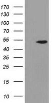 Western Blot: Adenylosuccinate Lyase Antibody (OTI2D10) - Azide and BSA Free [NBP2-70101] - HEK293T cells were transfected with the pCMV6-ENTRY control (Left lane) or pCMV6-ENTRY Adenylosuccinate Lyase (Right lane) cDNA for 48 hrs and lysed. Equivalent amounts of cell lysates (5 ug per lane) were separated by SDS-PAGE and immunoblotted with anti