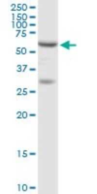 Western Blot: Adenylosuccinate Lyase Antibody [H00000158-D01P] - Analysis of ADSL expression in K-562.