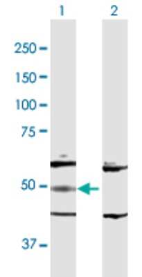 Western Blot: Adenylosuccinate Lyase Antibody [H00000158-D01P] - Analysis of ADSL expression in transfected 293T cell line by ADSL polyclonal antibody.Lane 1: ADSL transfected lysate(54.90 KDa).Lane 2: Non-transfected lysate.