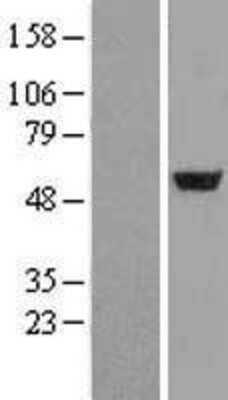 Western Blot: Adenylosuccinate Lyase Overexpression Lysate (Adult Normal) [NBL1-07363] Left-Empty vector transfected control cell lysate (HEK293 cell lysate); Right -Over-expression Lysate for Adenylosuccinate Lyase.