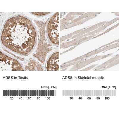 Immunohistochemistry-Paraffin: Adenylosuccinate Synthase Antibody [NBP1-90360] - Analysis in human testis and skeletal muscle tissues. Corresponding ADSS RNA-seq data are presented for the same tissues.